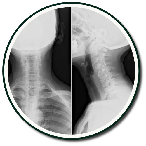 Gonstead X-Rays Gandia